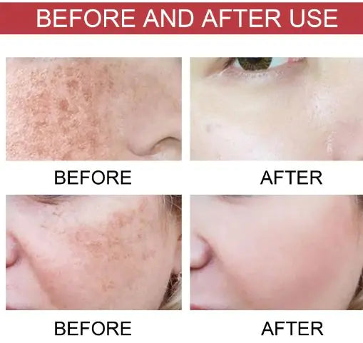 Luzaria Clarity Niacina