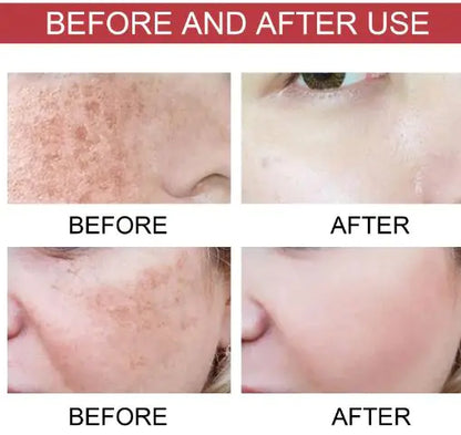 Luzaria Clarity Niacina