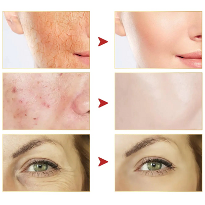 Luzaria Esencia de Caracol